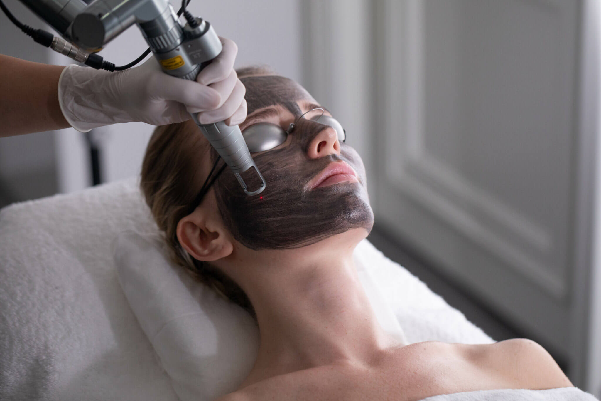 Carbon-Laser-Facial