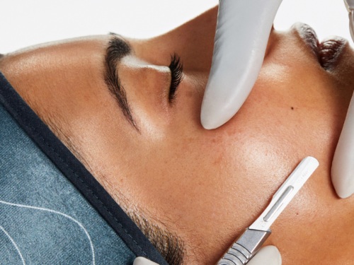 dermaplaning my body clinic